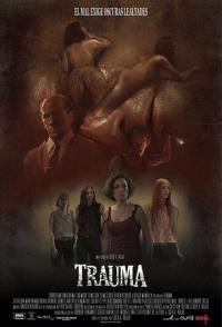 Травма